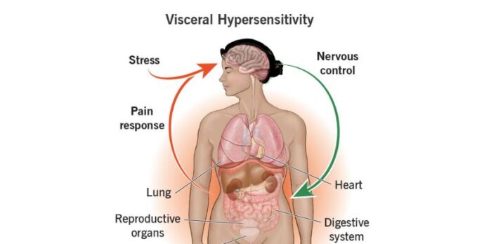 Visceral Hypersensitivity